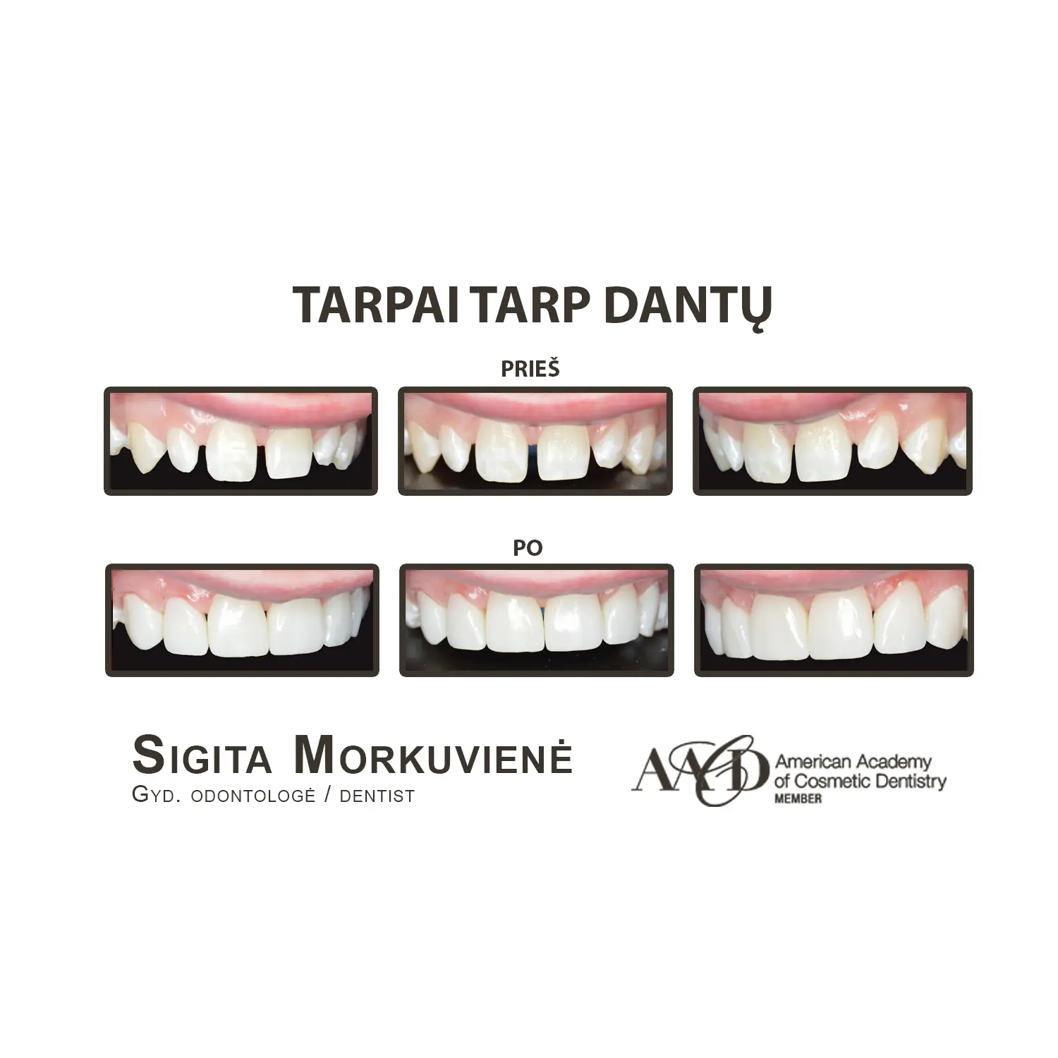 Cosmetic Dentistry gallery 1