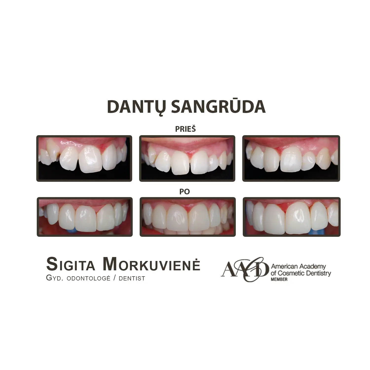 Cosmetic Dentistry gallery 4