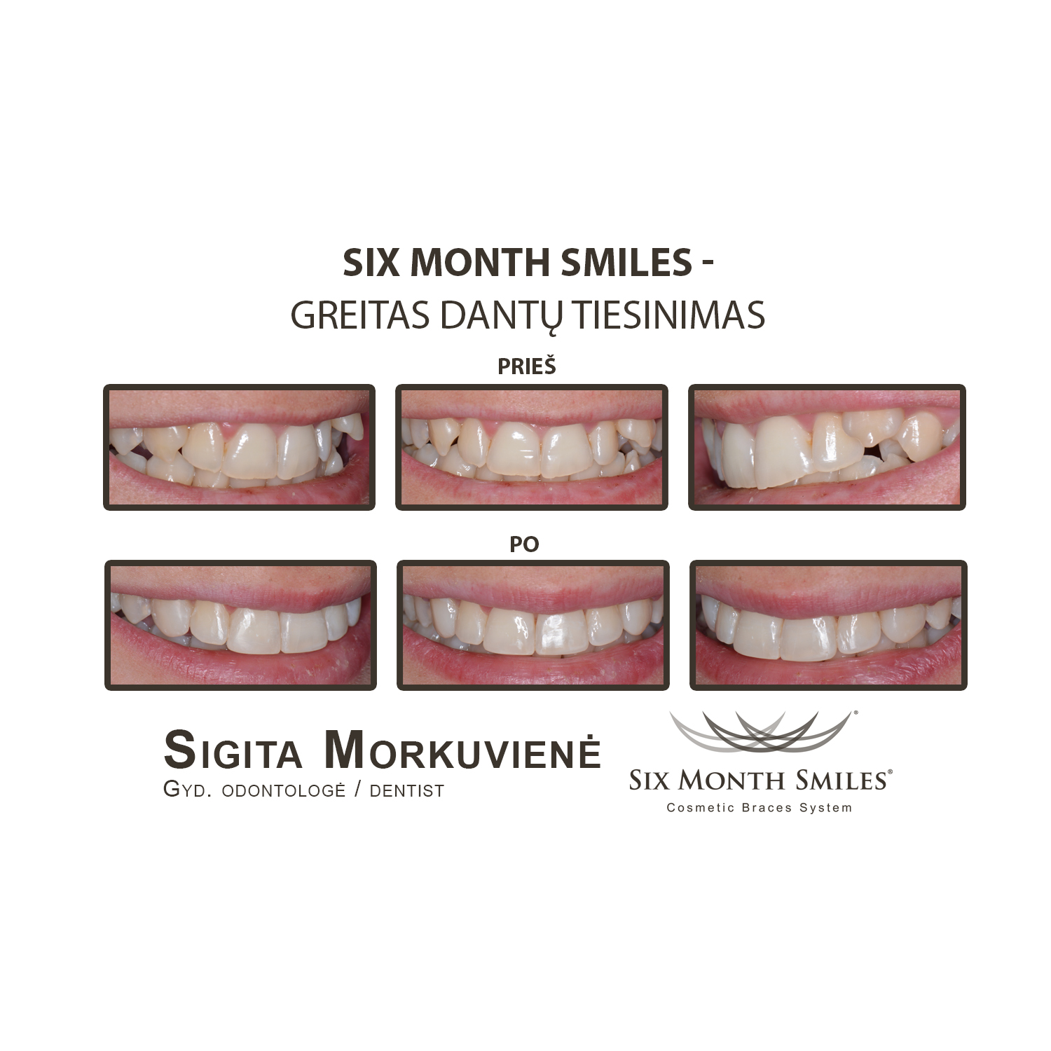 Six Month Smiles_24