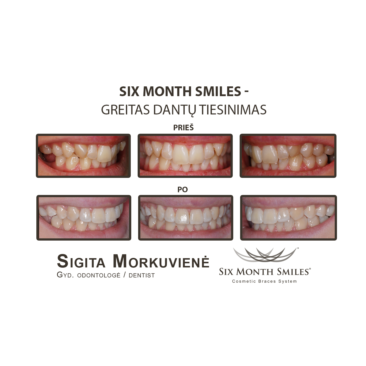 Six Month Smiles_31 (1)